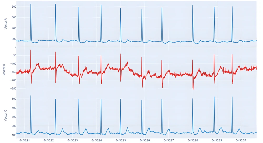 A 10-second ECG sample for vectors A, B and C, from 04:55:21 to 04:55:30.